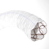 ステントグラフト