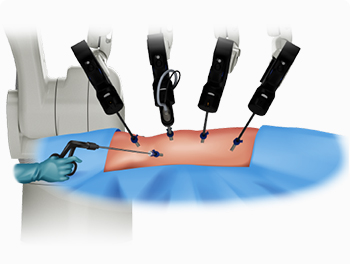 創部の疼痛軽減